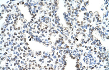 WDR6 Antibody