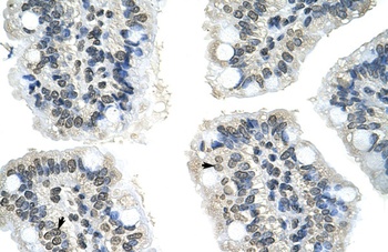 GIPC2 Antibody