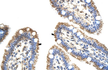 FZD9 Antibody