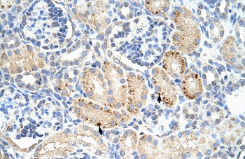 FZD7 Antibody