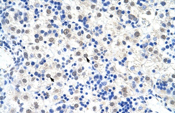 DDX47 Antibody