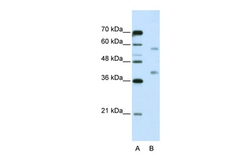 HNRNPA3 Antibody
