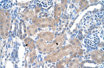 SEPSECS Antibody