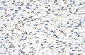 MGC42174 Antibody