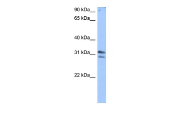 TRMT10B Antibody