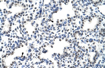 HNRNPLL Antibody