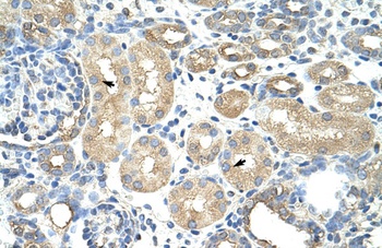 RAVER1 Antibody