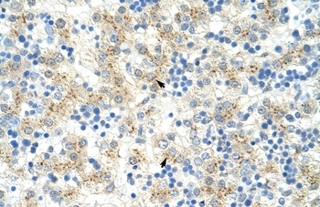 EXOSC6 Antibody