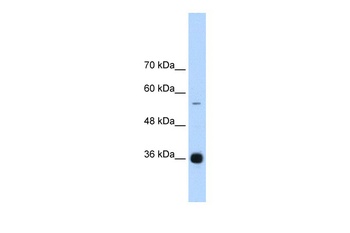 HNRNPAB Antibody