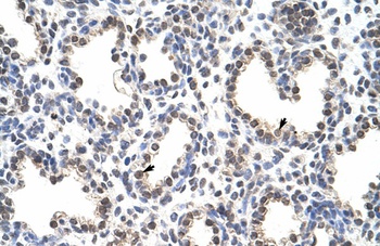 CPSF7 Antibody