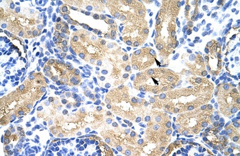 MTHFSD Antibody