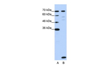 LSM2 Antibody