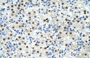 EXOSC4 Antibody