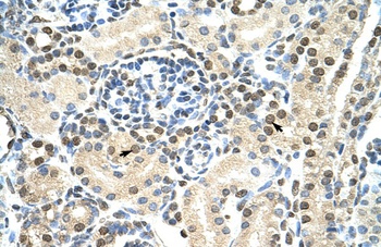 DAZAP1 Antibody