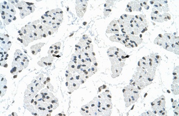 RBM22 Antibody