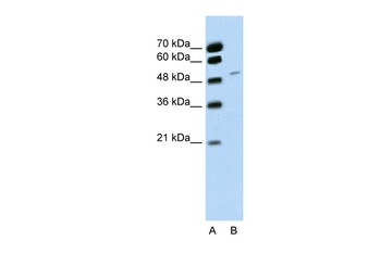 RBM22 Antibody