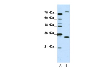 EXOSC2 Antibody