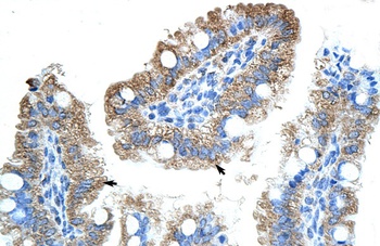 OLA1 Antibody