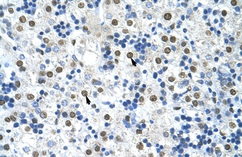 HNRNPA0 Antibody