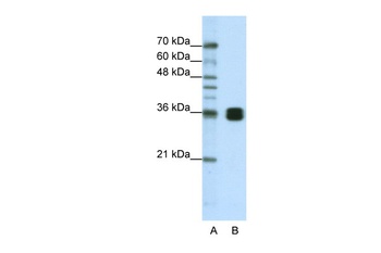 HNRNPA0 Antibody
