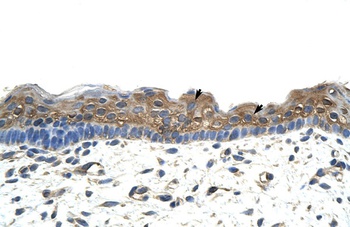 APOBEC2 Antibody