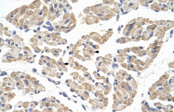 FARS2 Antibody