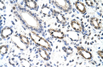 KHDRBS3 Antibody