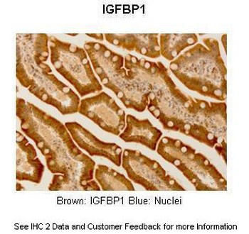 IGF2BP1 Antibody