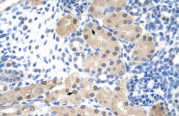 RNASEH2A Antibody