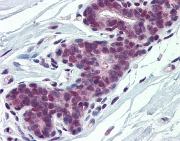 PCBP1 Antibody