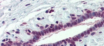 PCBP1 Antibody