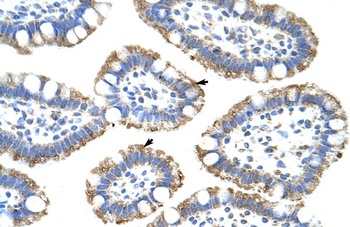 SF3B4 Antibody