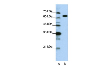 KARS Antibody