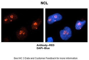 NCL Antibody