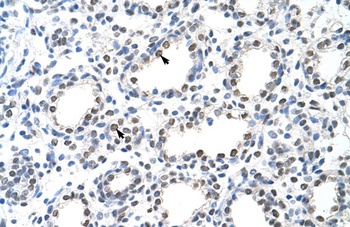 THOC1 Antibody