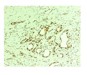 THOC1 Antibody