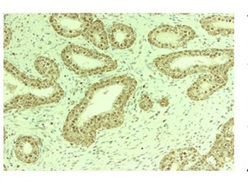 THOC1 Antibody