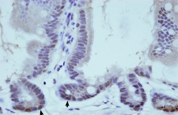 THOC1 Antibody