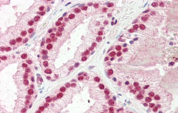 SNRPA Antibody