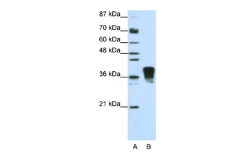 TRA2B Antibody