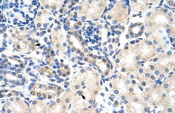 PABPC4 Antibody