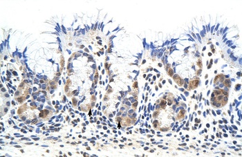 PRKRA Antibody