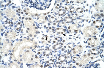 SSB Antibody