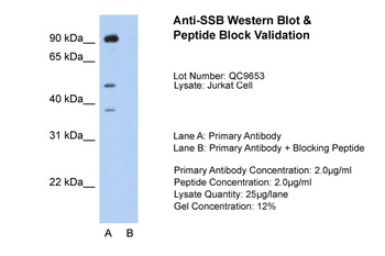 SSB Antibody