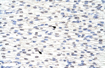SNRPF Antibody
