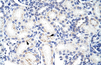 SNRPA1 Antibody