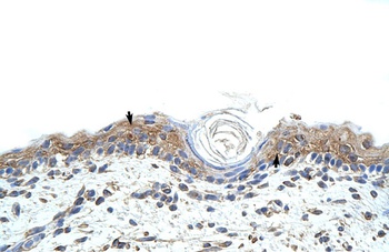 RBMS1 Antibody