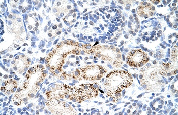 PPP1R8 Antibody