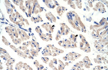 ACO1 Antibody