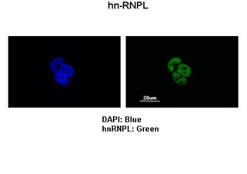 HNRNPL Antibody